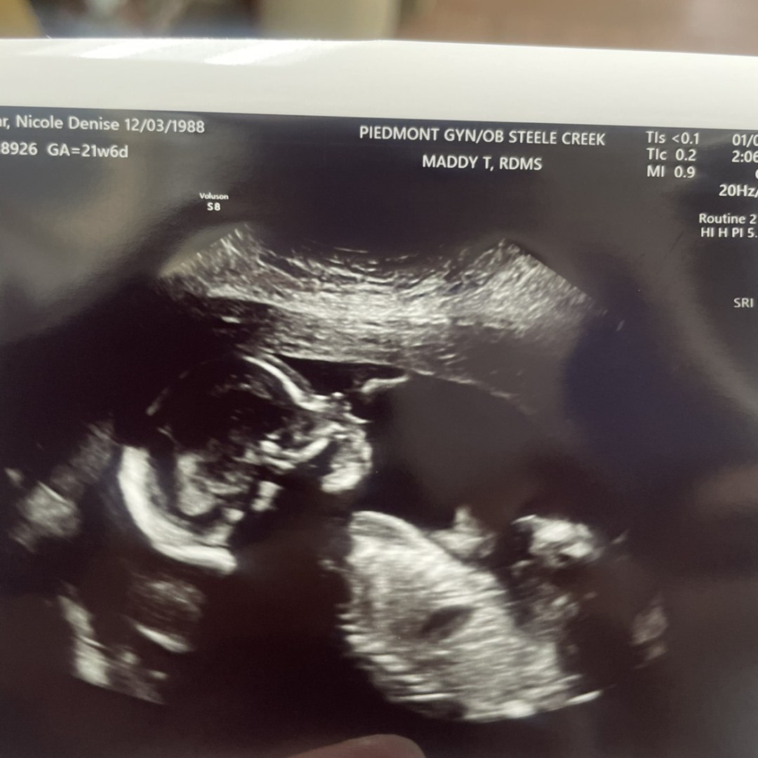 Photo shared by Nicole for their Babylist baby registry.