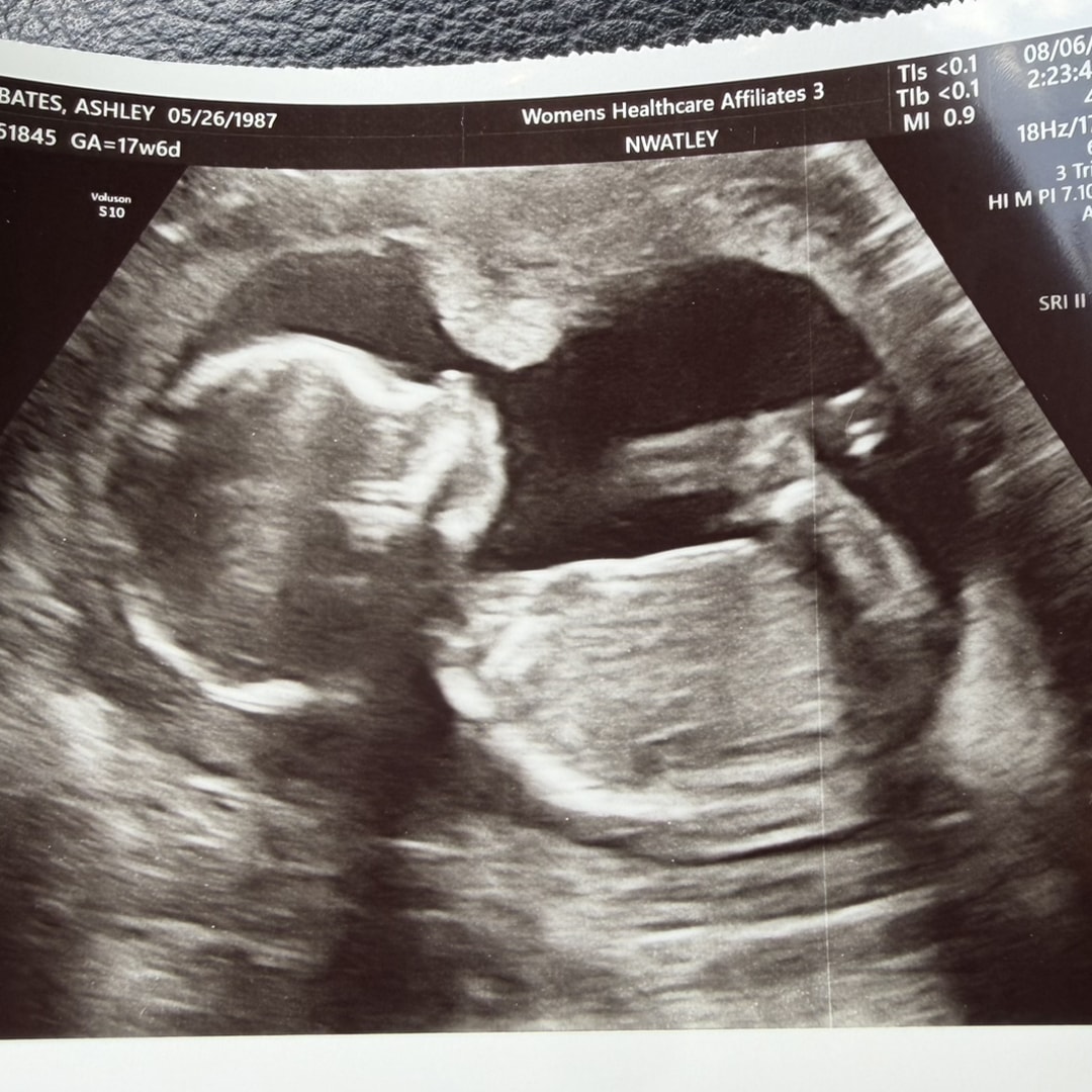 Photo shared by Ashley for their Babylist baby registry.