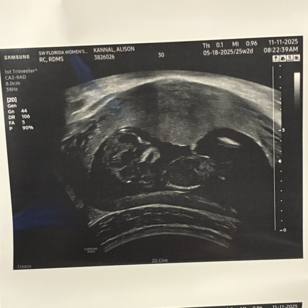 Photo shared by Alison for their Babylist baby registry.