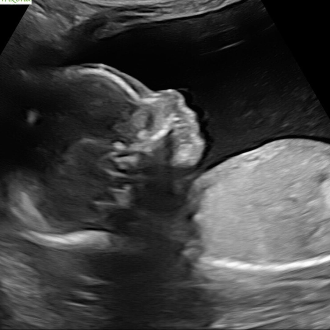 Photo shared by Caitlin for their Babylist baby registry.