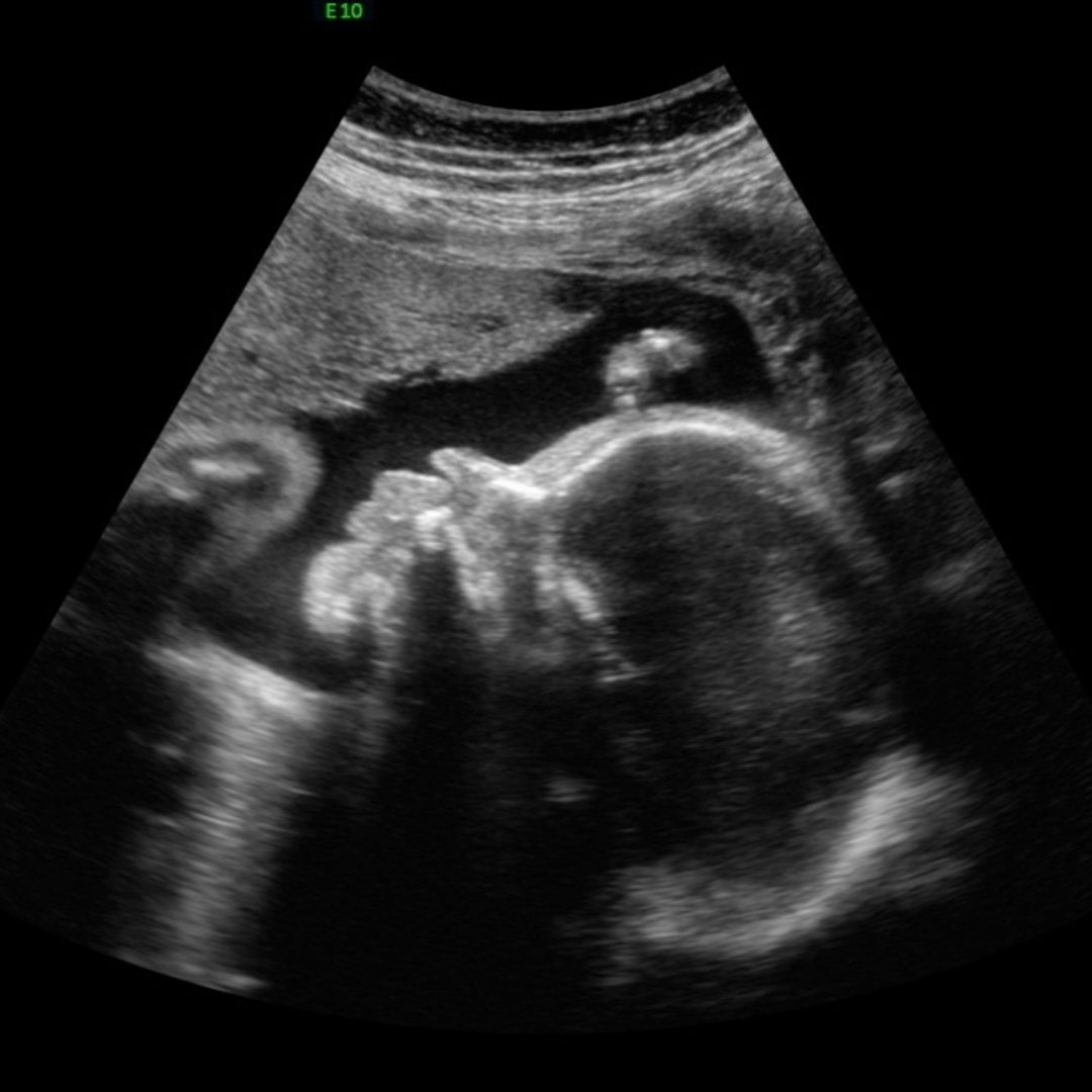 Photo shared by Gyzelle Jena for their Babylist baby registry.