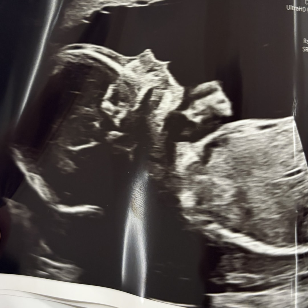 Photo shared by Morgan for their Babylist baby registry.