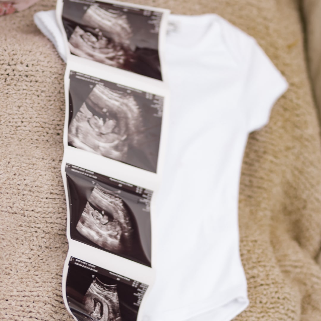 Photo shared by Gracie for their Babylist baby registry.
