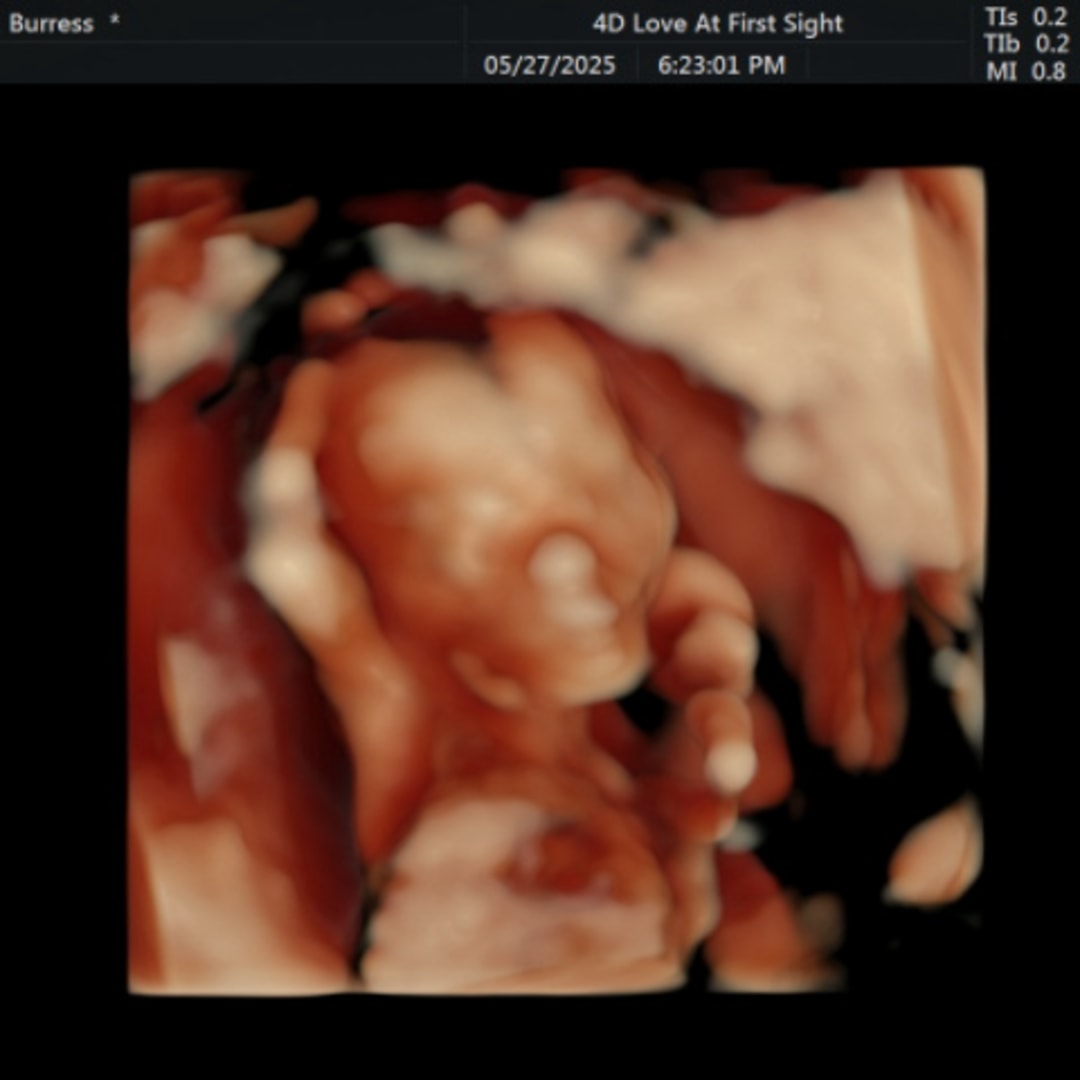 Photo shared by Allysia for their Babylist baby registry.