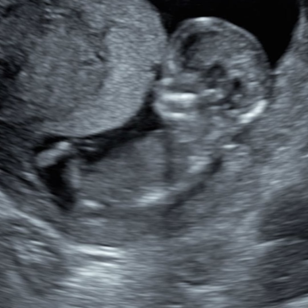 Photo shared by Brittany for their Babylist baby registry.