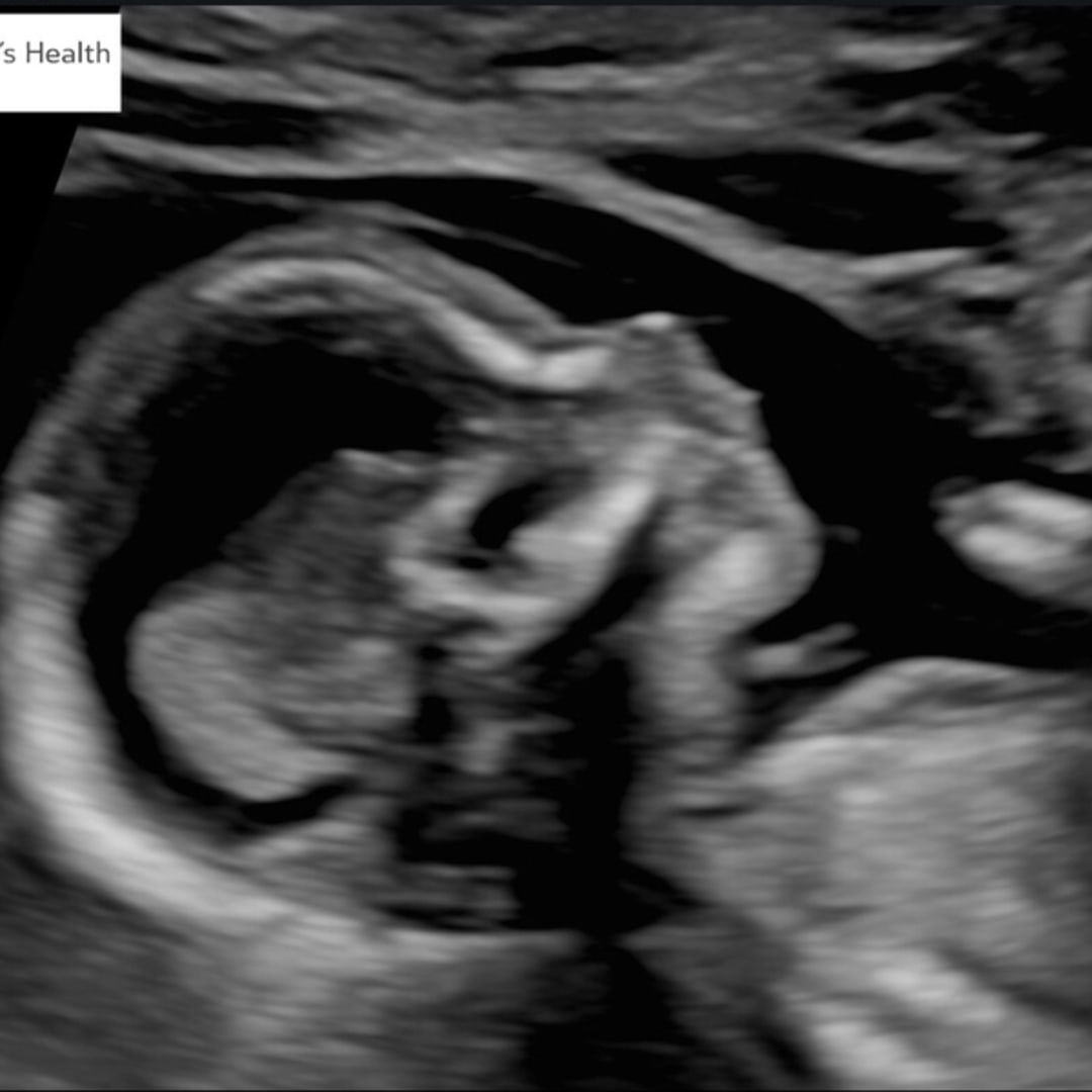 Photo shared by Savanah for their Babylist baby registry.