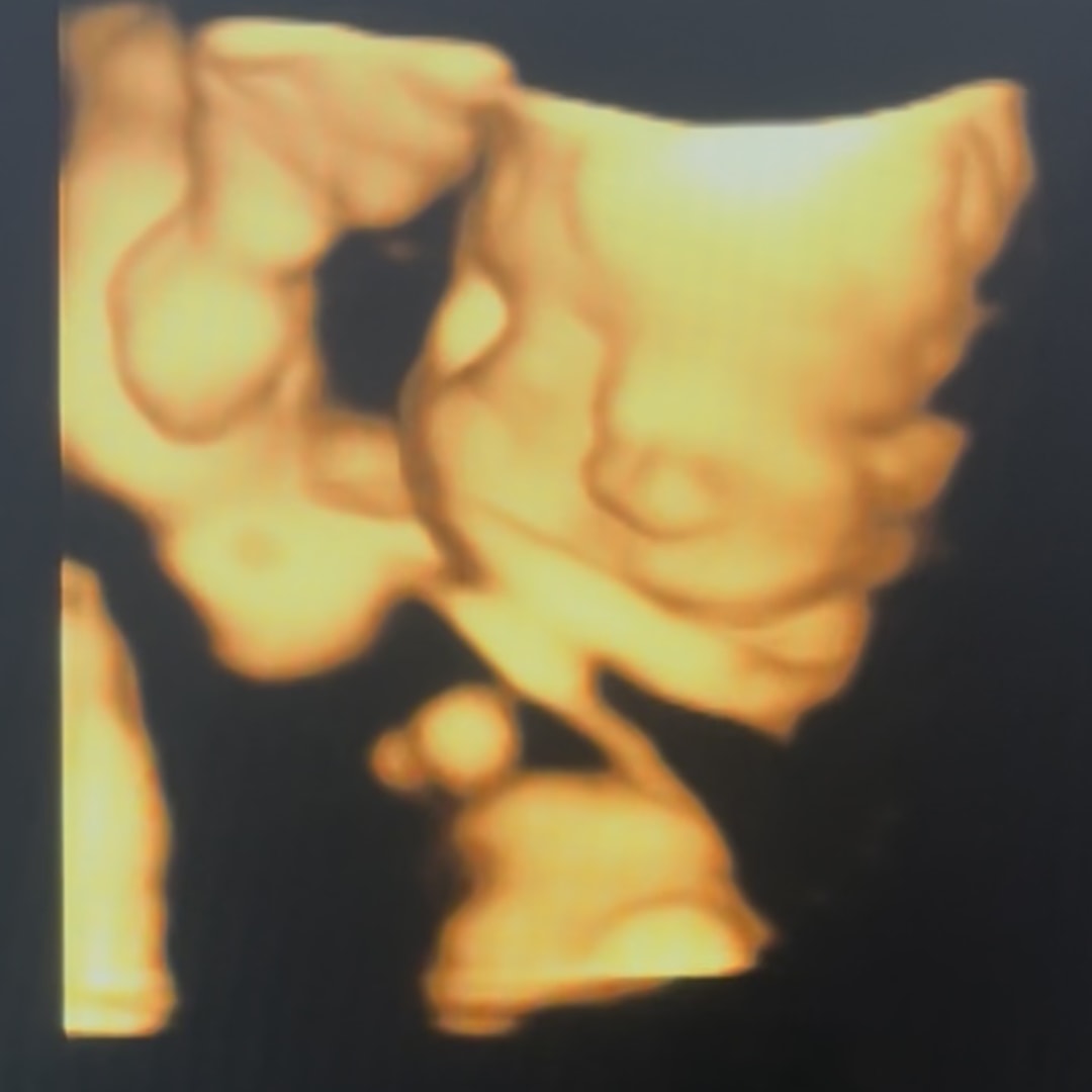 Photo shared by Britney for their Babylist baby registry.