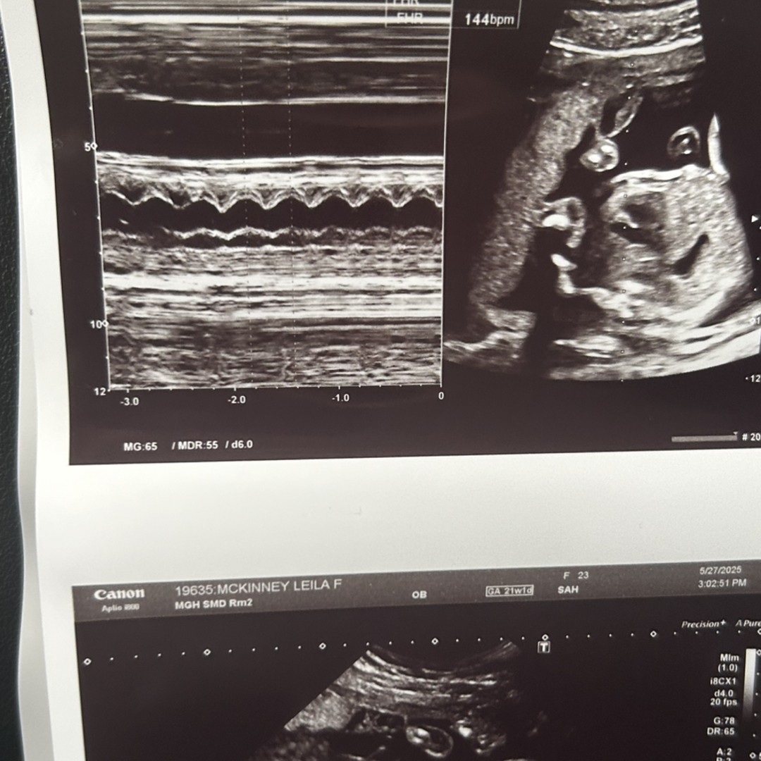 Photo shared by Kevin for their Babylist baby registry.