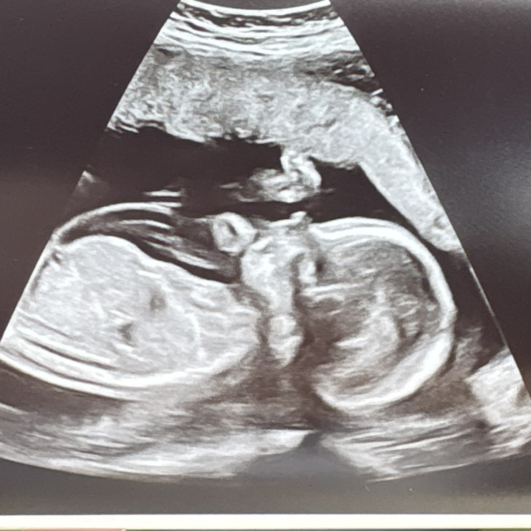 Photo shared by Gabrielle for their Babylist baby registry.