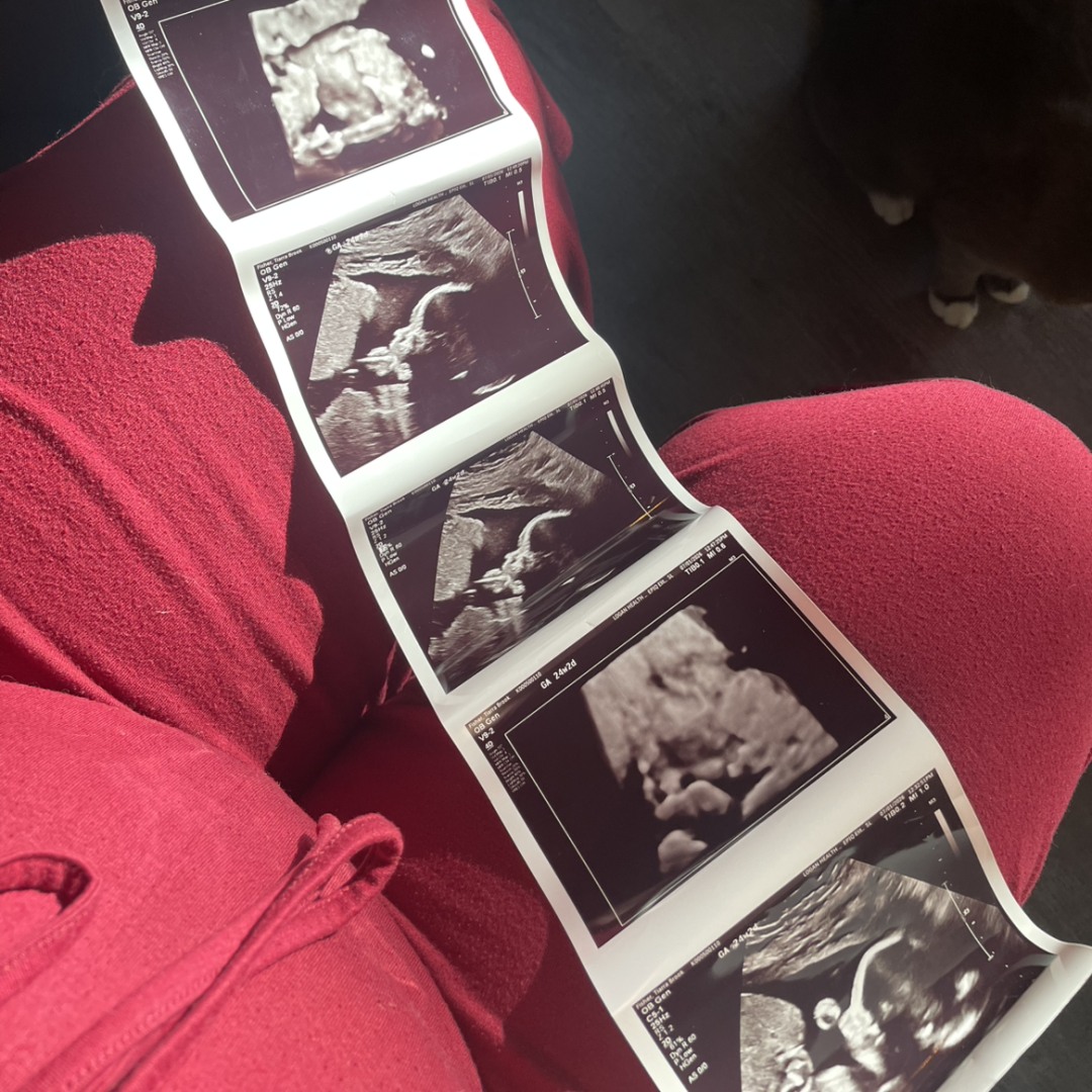 Photo shared by Brooke for their Babylist baby registry.