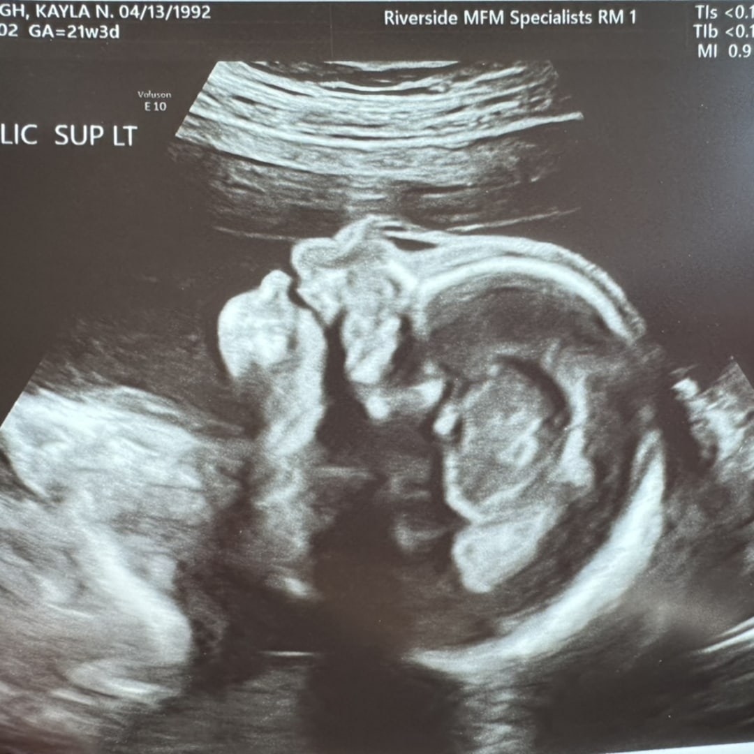Photo shared by Kayla for their Babylist baby registry.