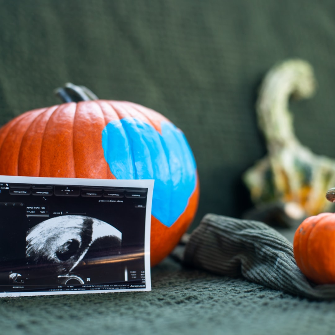 Photo shared by Chelsey for their Babylist baby registry.