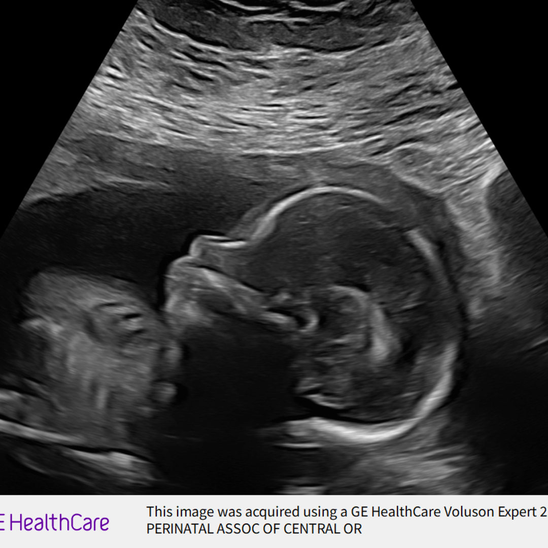 Photo shared by Cheyanne for their Babylist baby registry.