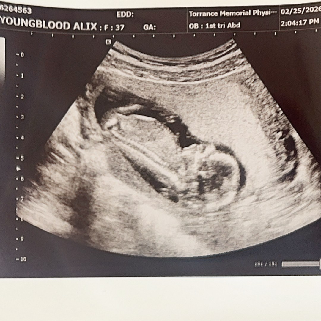 Photo shared by Alix for their Babylist baby registry.