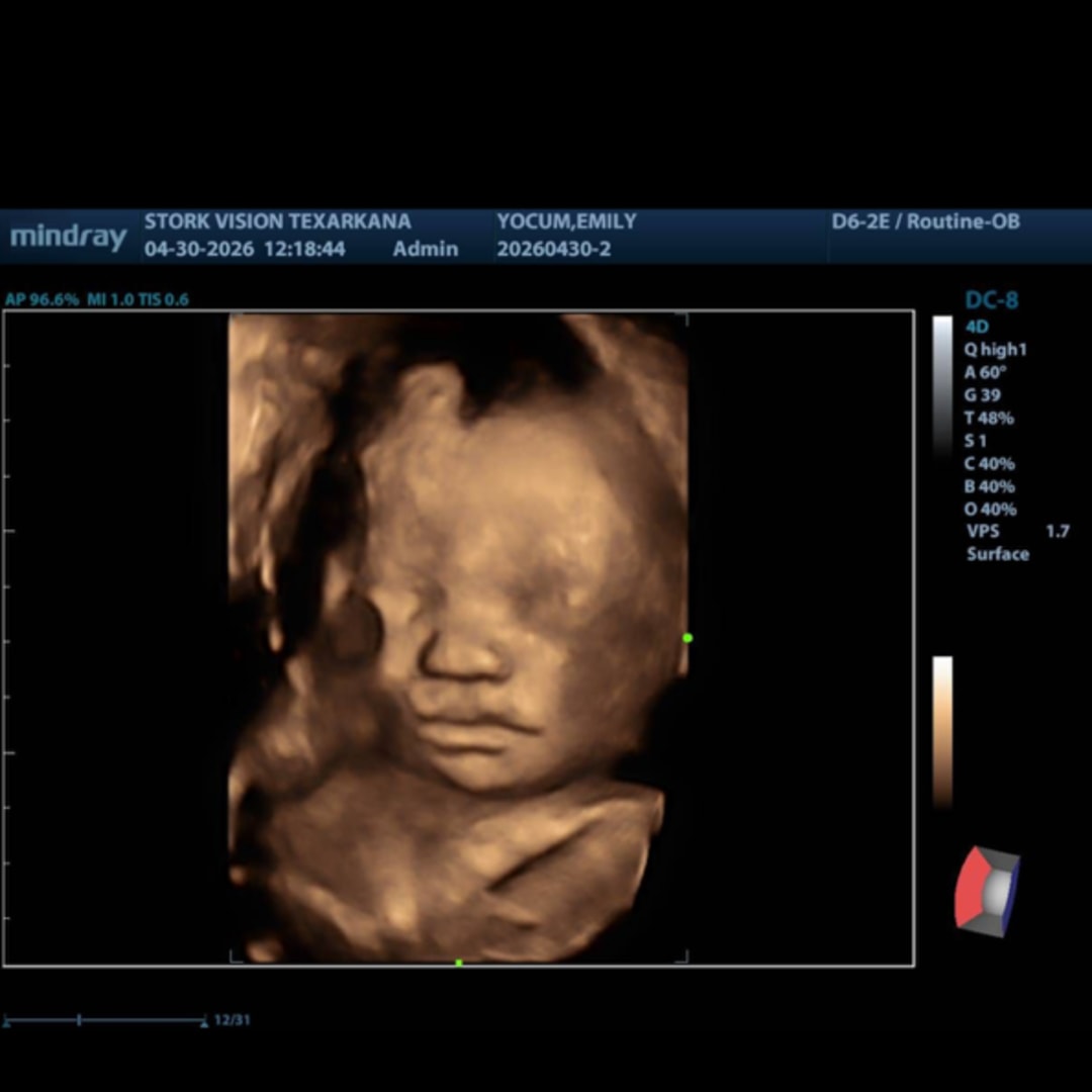 Photo shared by Emily for their Babylist baby registry.