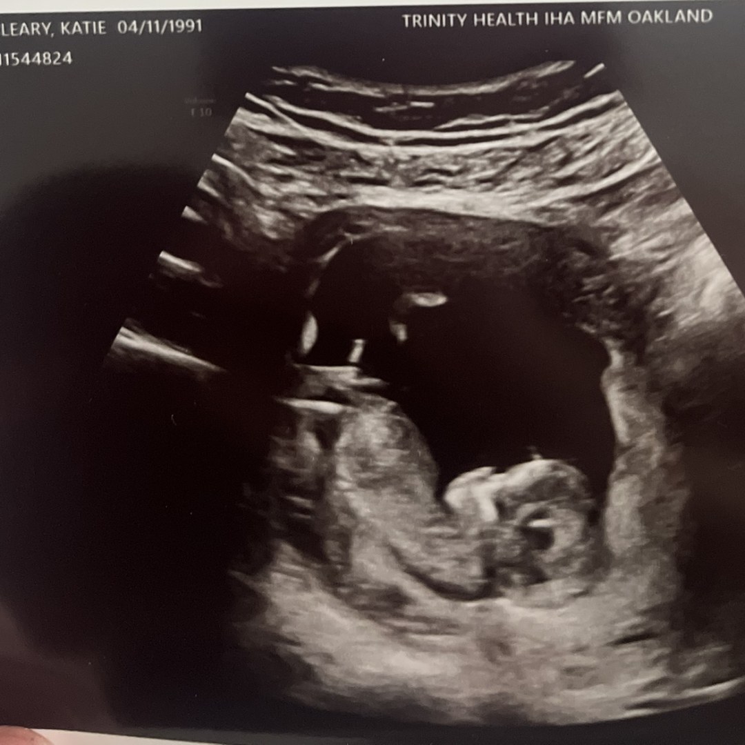 Photo shared by Katie for their Babylist baby registry.