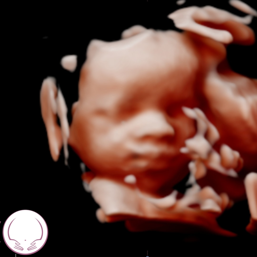 Photo shared by Emily for their Babylist baby registry.