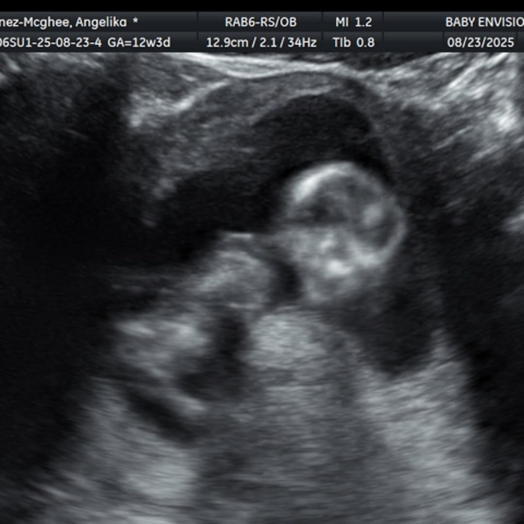 Photo shared by Angelika for their Babylist baby registry.