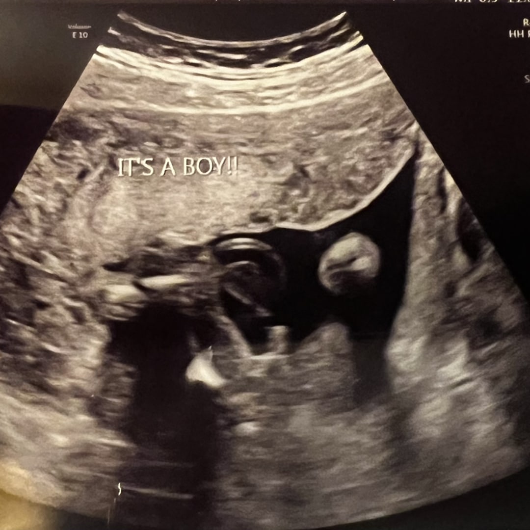 Photo shared by Tylnda for their Babylist baby registry.