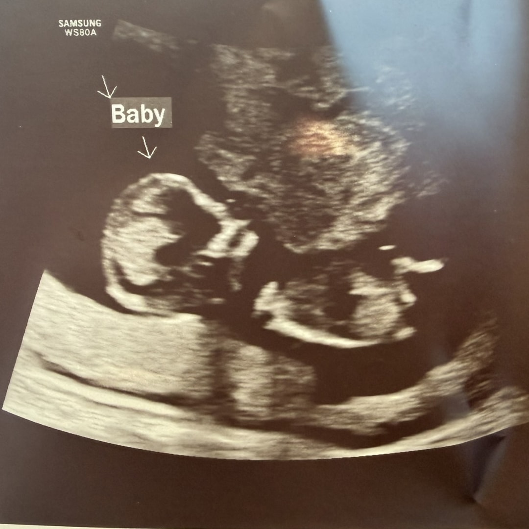 Photo shared by Alexandra for their Babylist baby registry.