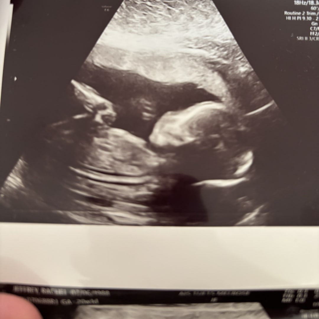 Photo shared by Rachel for their Babylist baby registry.