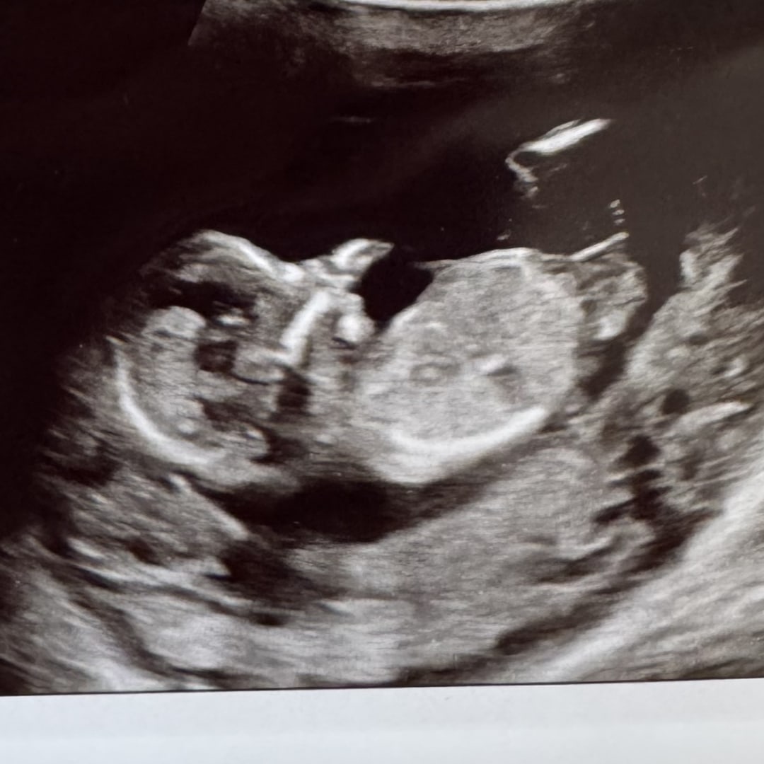 Photo shared by Amber for their Babylist baby registry.