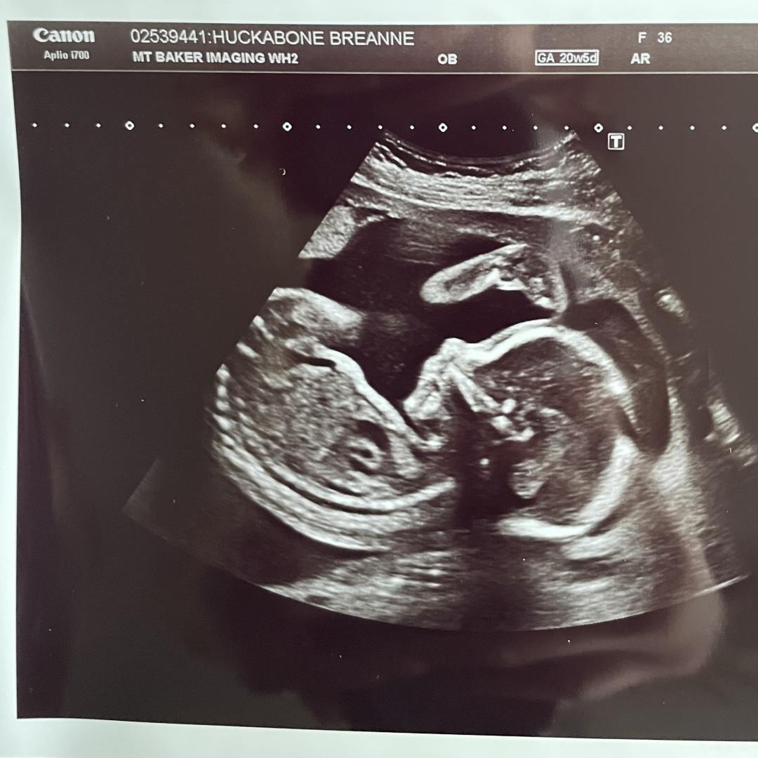 Photo shared by Breanne for their Babylist baby registry.