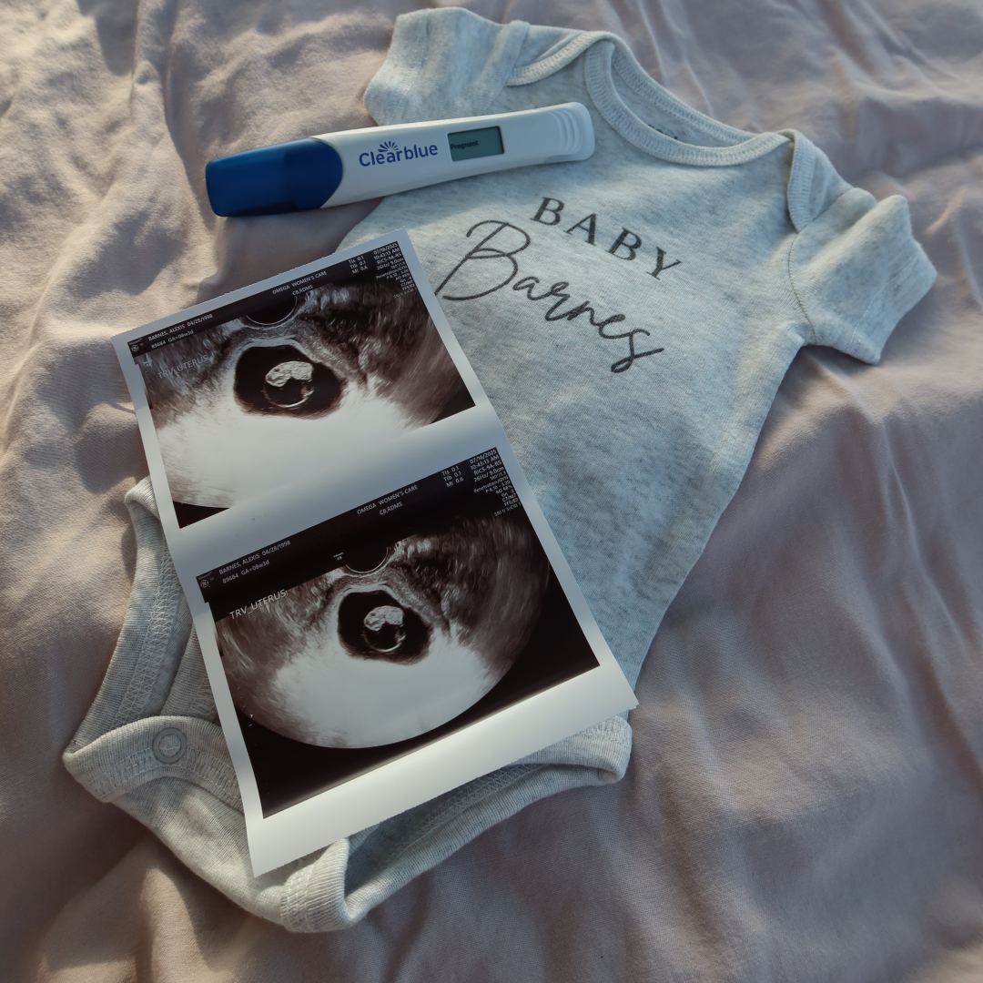 Photo shared by Lexie for their Babylist baby registry.