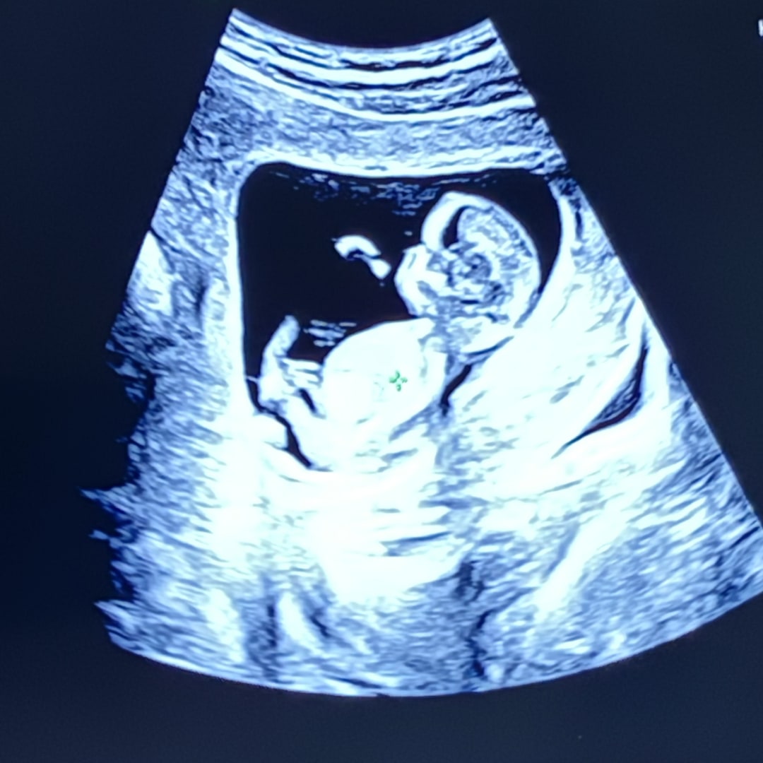Photo shared by Ariel for their Babylist baby registry.