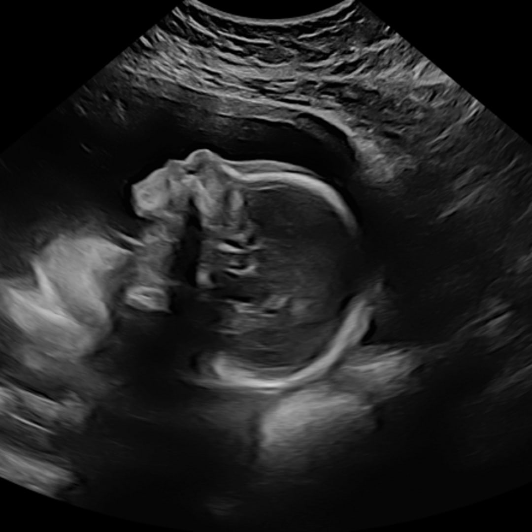 Photo shared by Hannah for their Babylist baby registry.