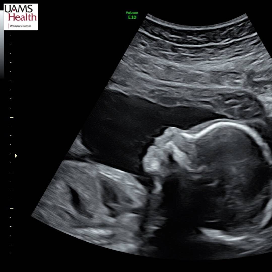 Photo shared by Abby for their Babylist baby registry.