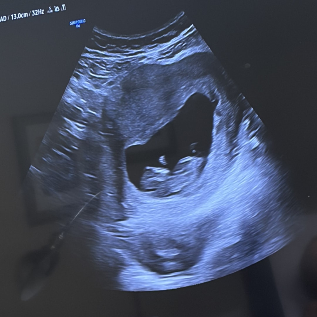 Photo shared by Katelyn for their Babylist baby registry.
