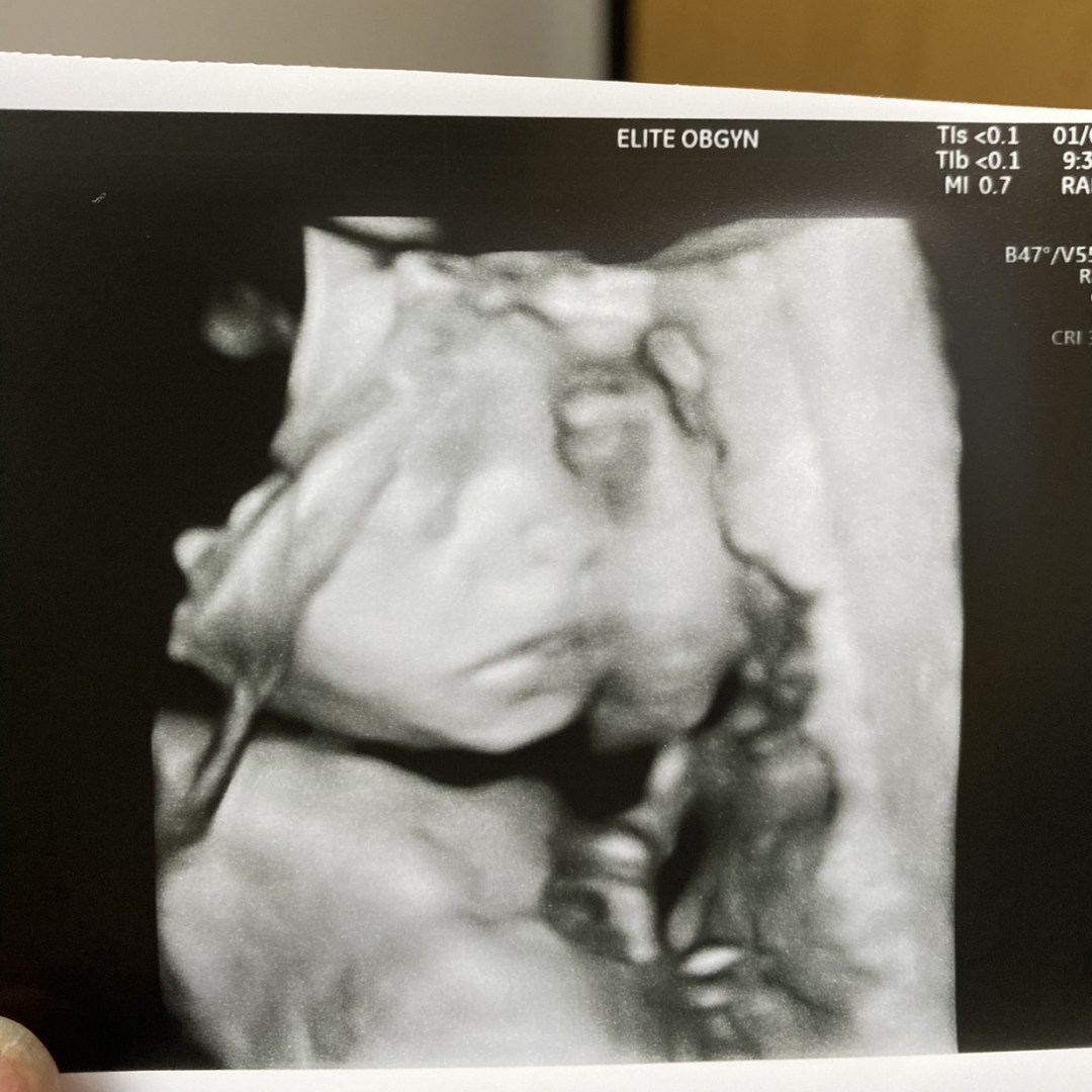 Photo shared by Nicole for their Babylist baby registry.