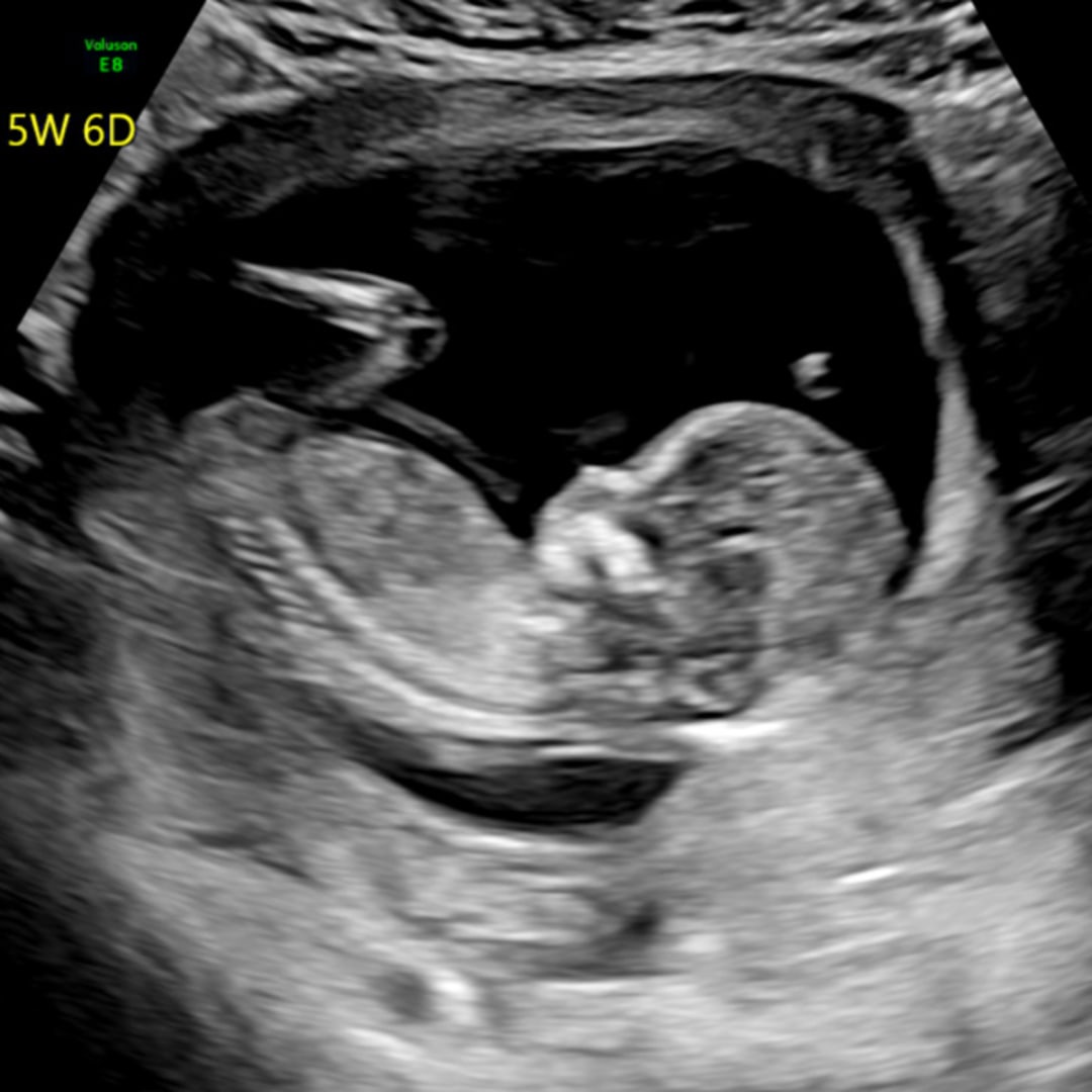 Photo shared by Makayla for their Babylist baby registry.