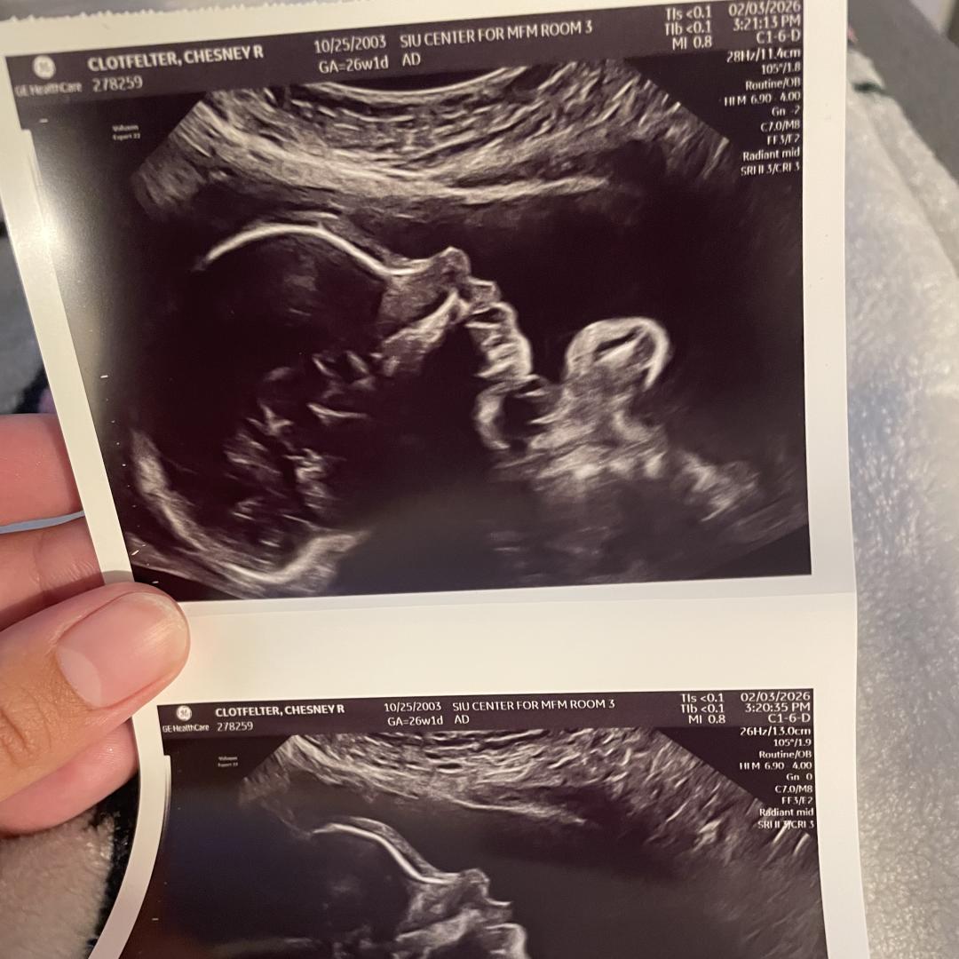 Photo shared by Chesney for their Babylist baby registry.