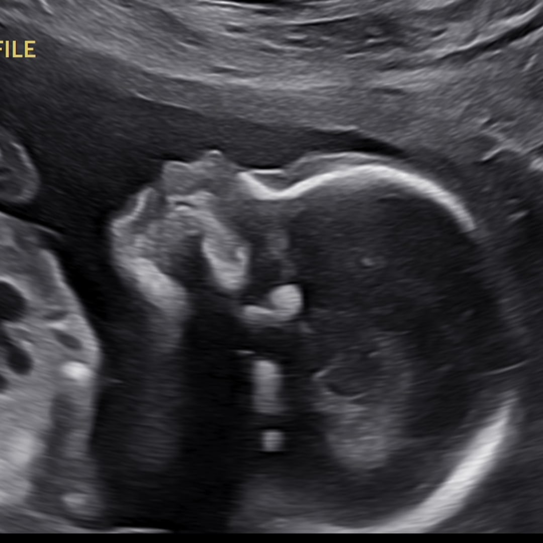 Photo shared by Vicki for their Babylist baby registry.