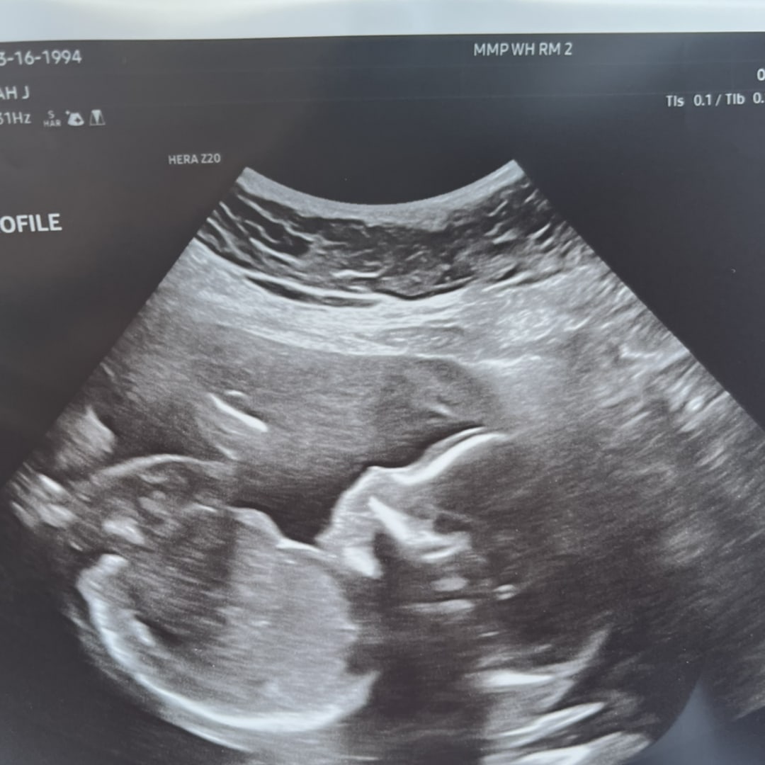 Photo shared by Sarah for their Babylist baby registry.