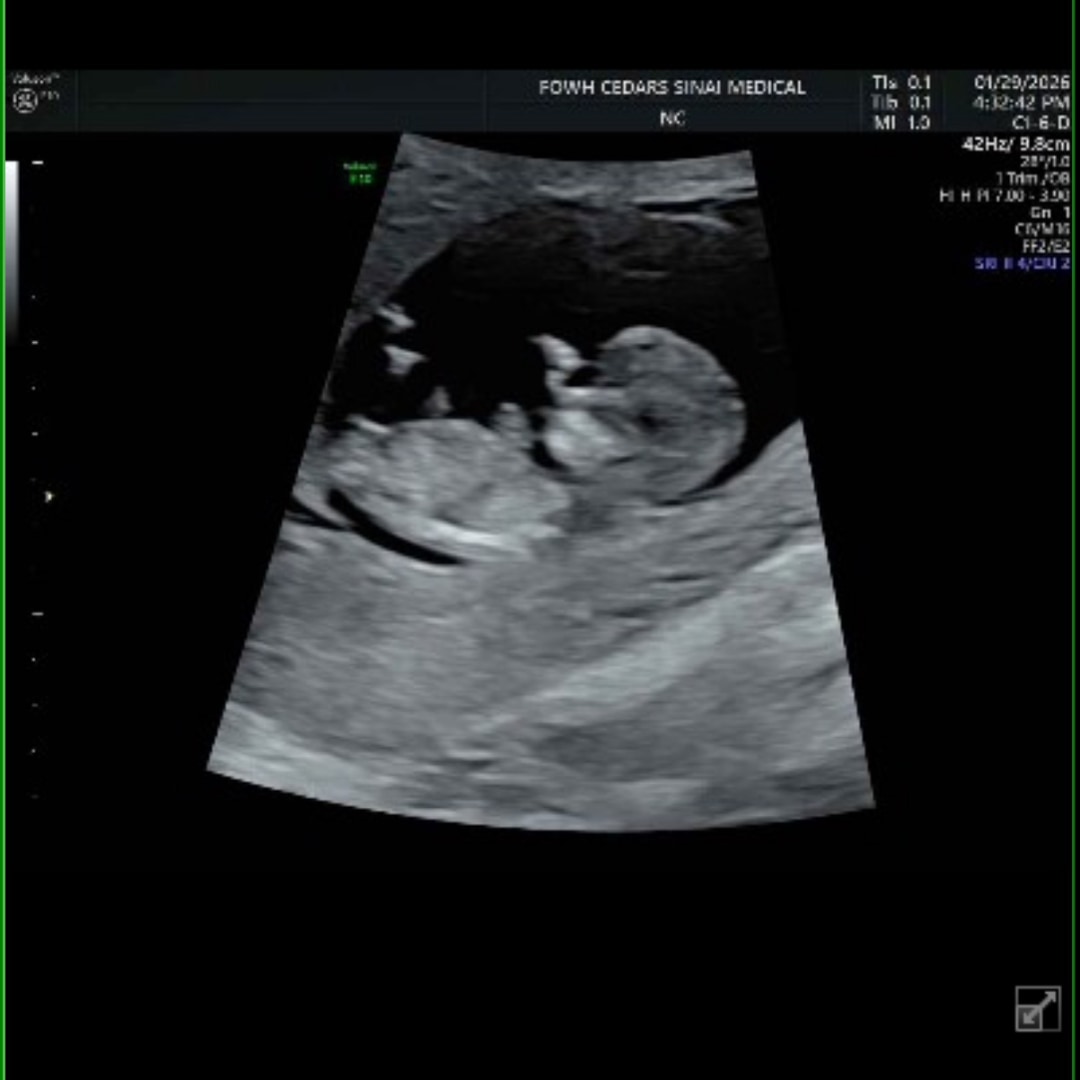Photo shared by Serina for their Babylist baby registry.