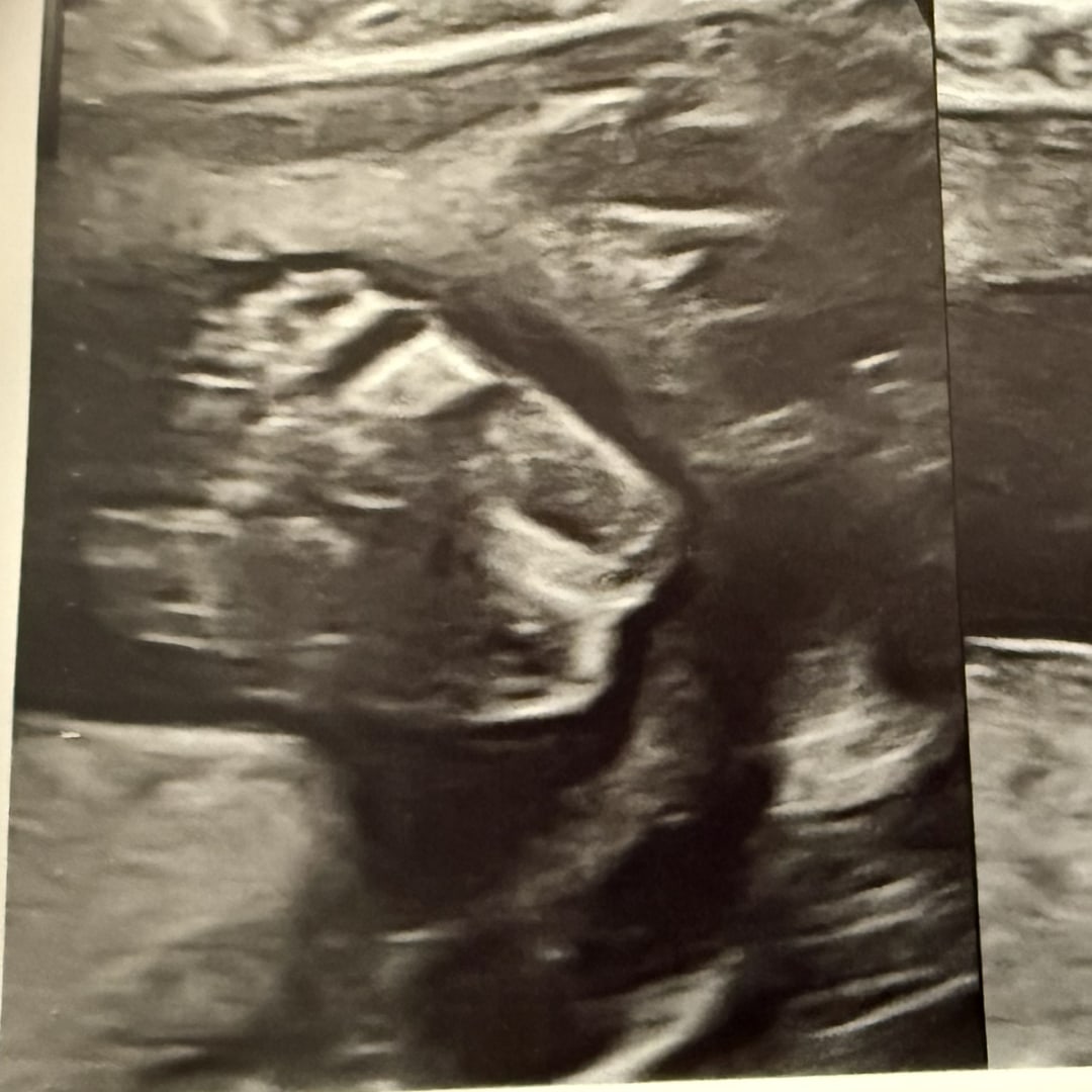 Photo shared by Victoria for their Babylist baby registry.