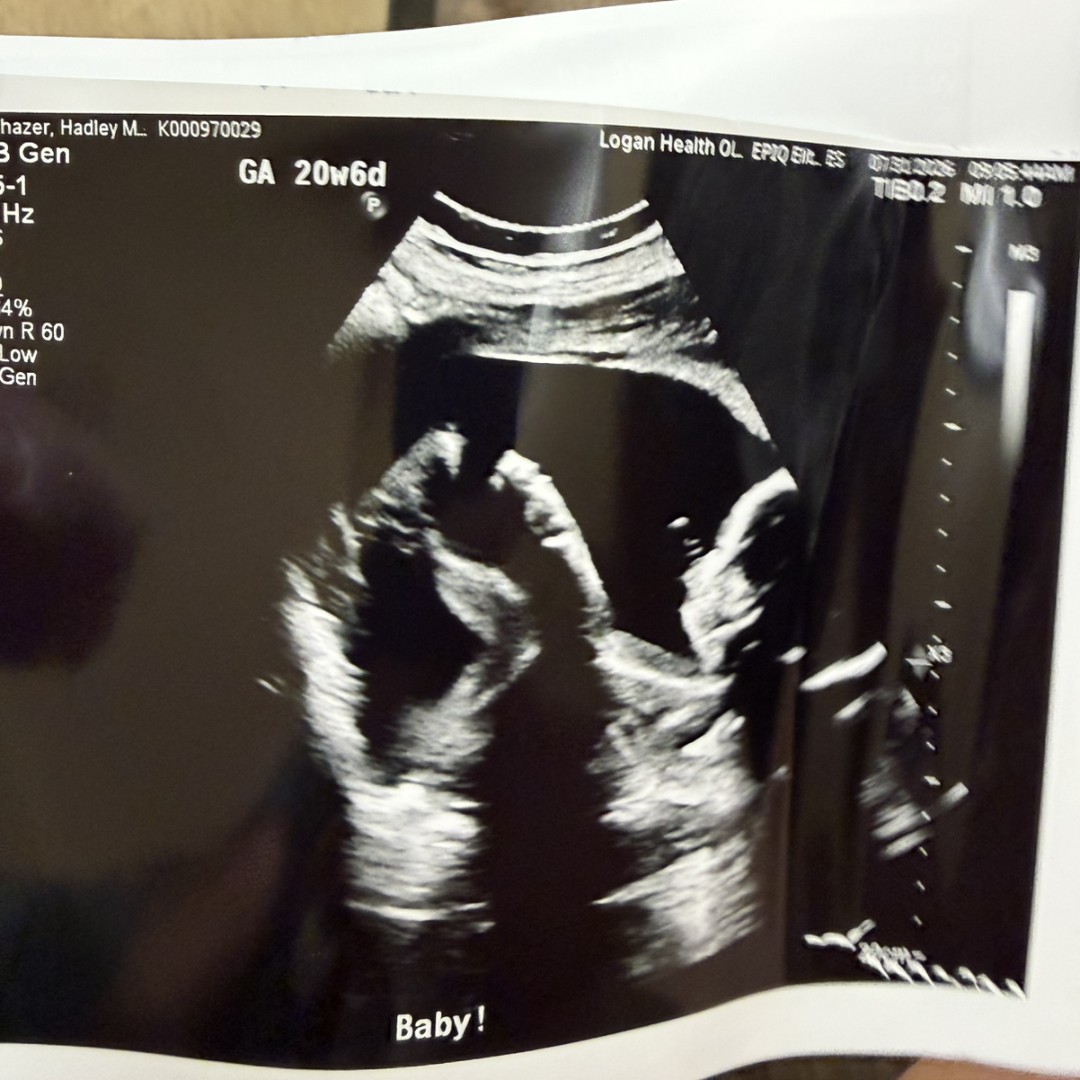 Photo shared by Hadley for their Babylist baby registry.