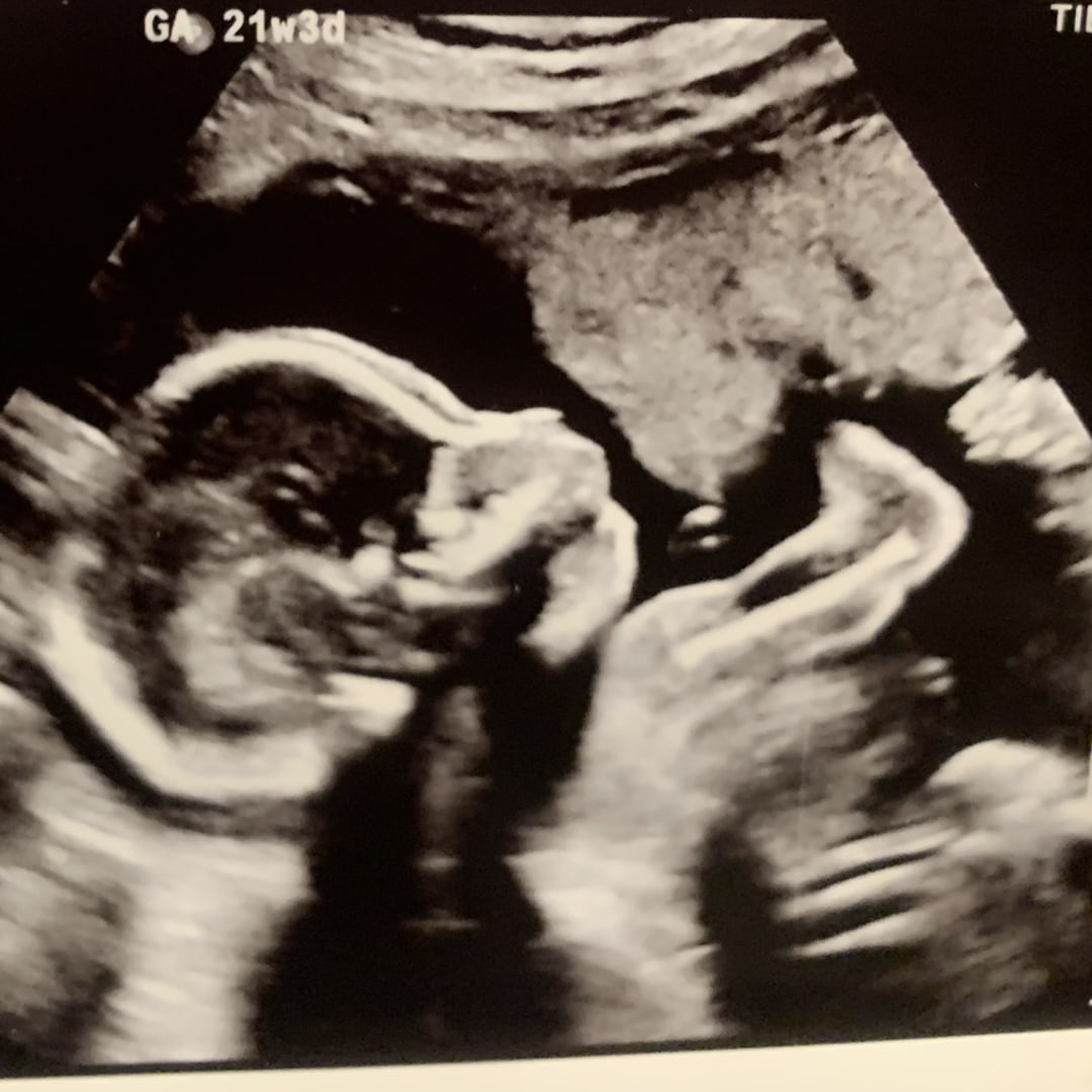 Photo shared by Jazlyn for their Babylist baby registry.