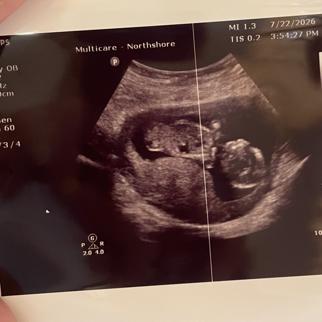 Photo shared by Adelina for their Babylist baby registry.