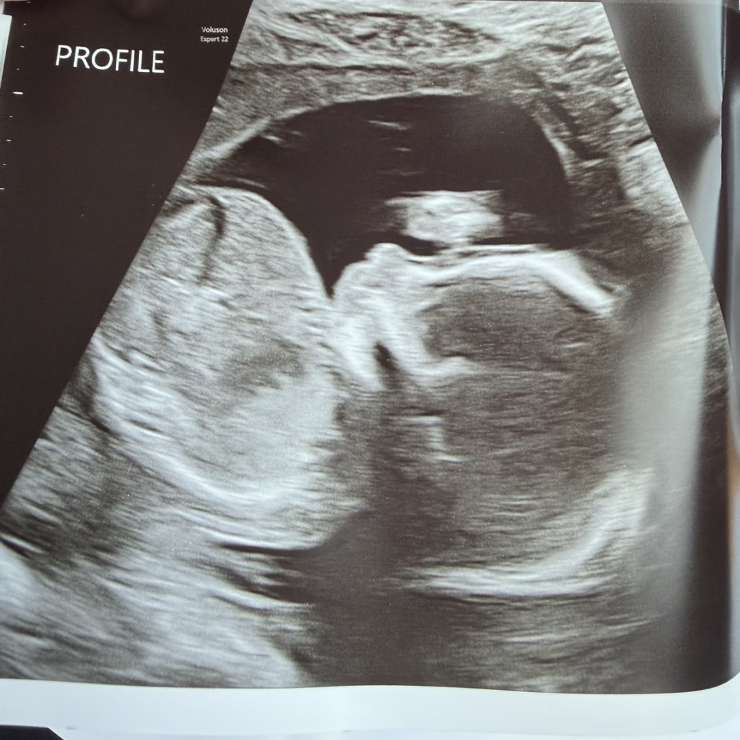 Photo shared by Alix for their Babylist baby registry.