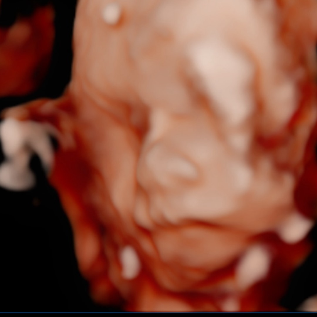 Photo shared by Alexis for their Babylist baby registry.