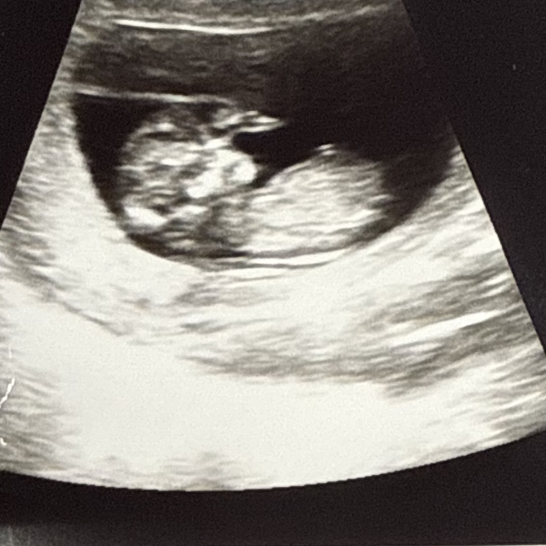 Photo shared by Erica for their Babylist baby registry.