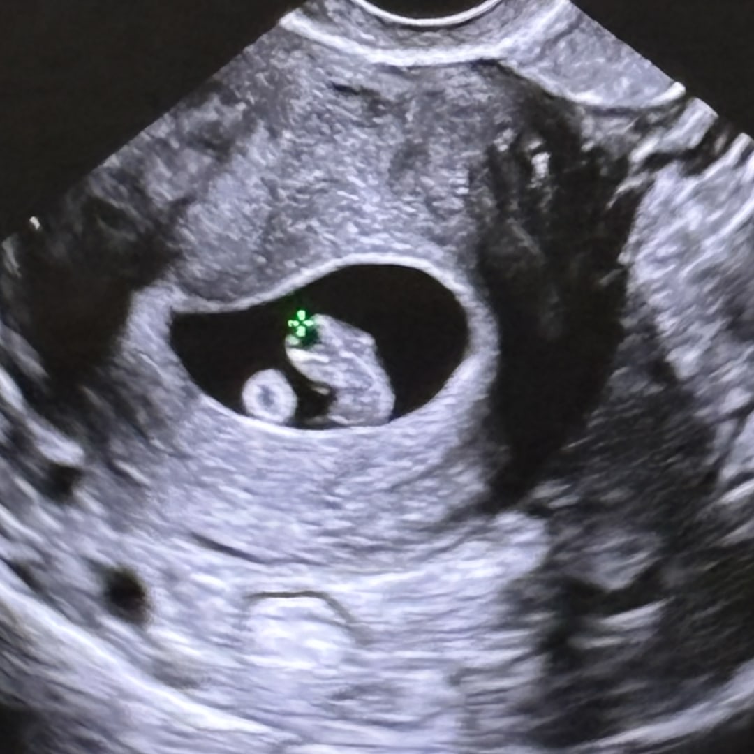 Photo shared by Kimber for their Babylist baby registry.