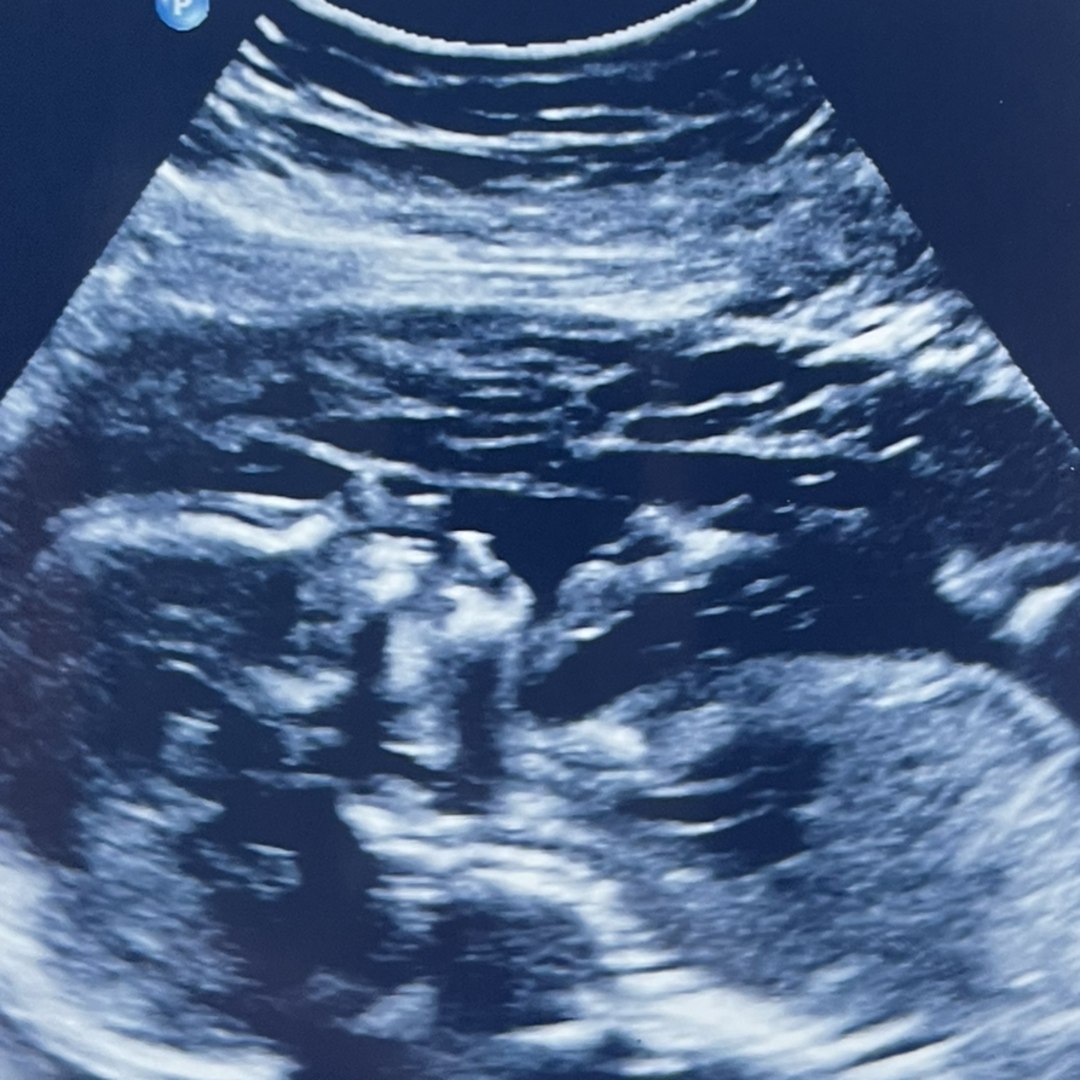 Photo shared by Dayton for their Babylist baby registry.