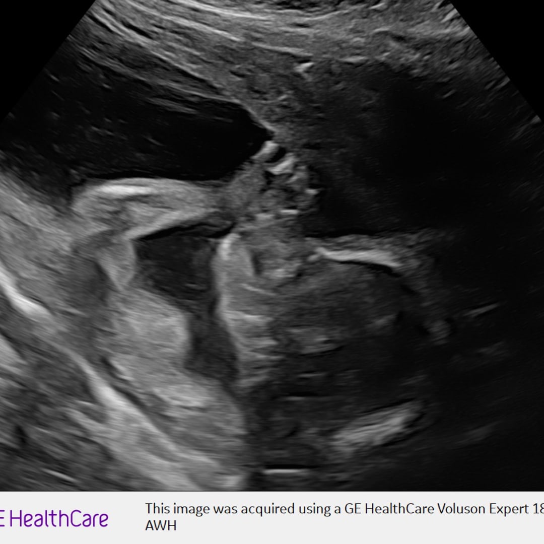 Photo shared by Courtney for their Babylist baby registry.