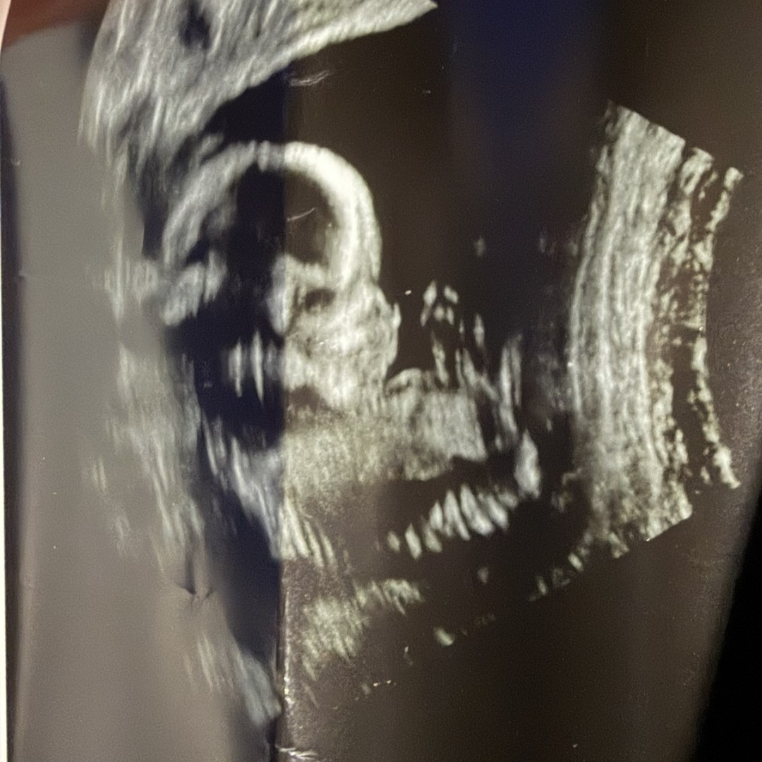 Photo shared by Jessica for their Babylist baby registry.