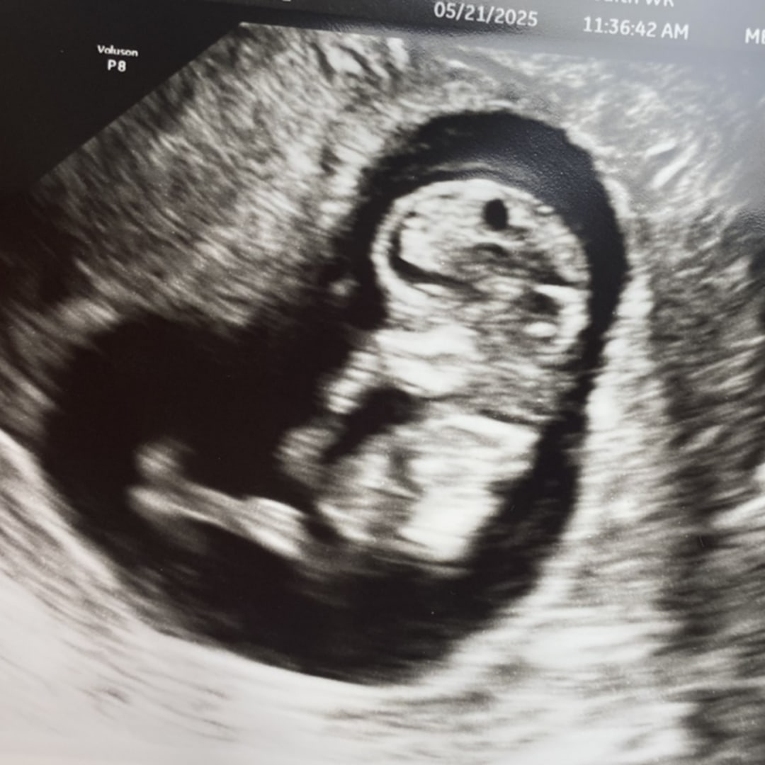 Photo shared by Carlie for their Babylist baby registry.